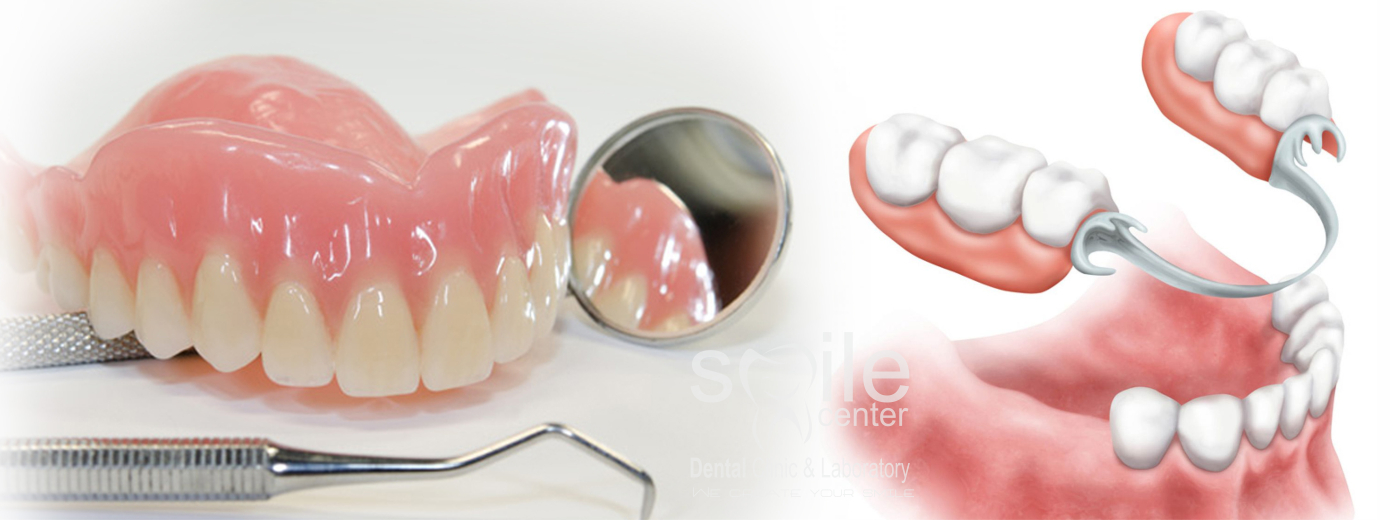 Protez Uygulamaları ve Tedavileri